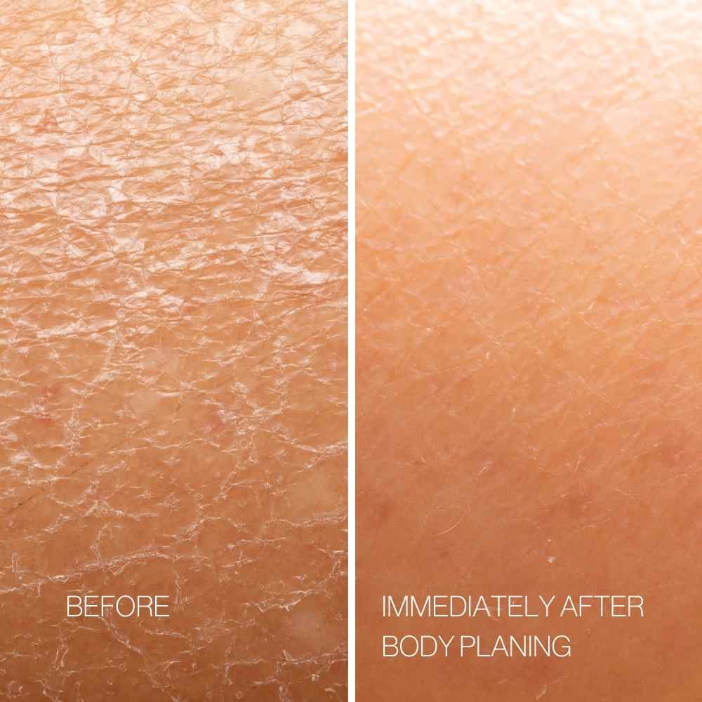Body Plane Set - Image 5
