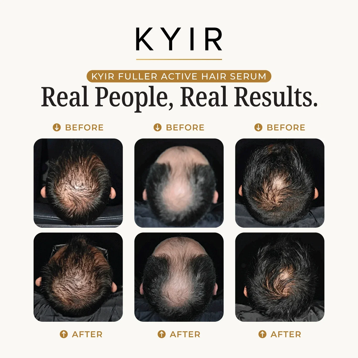 Kyir FULLER Active Hair Serum - Image 3